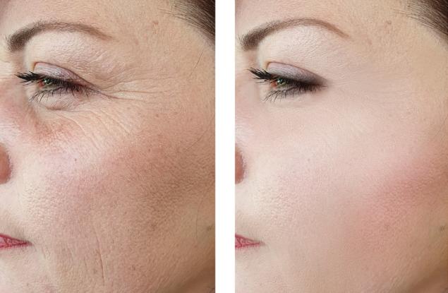 Най-важният признак за остаряването при жените — и това съвсем не са бръчките