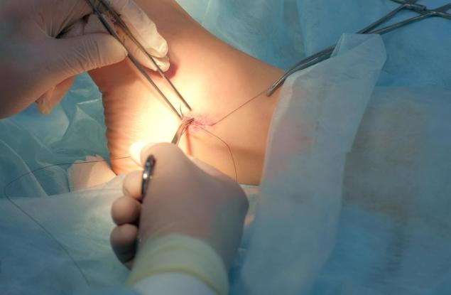 Този лекар извършва три сериозни операции върху себе си