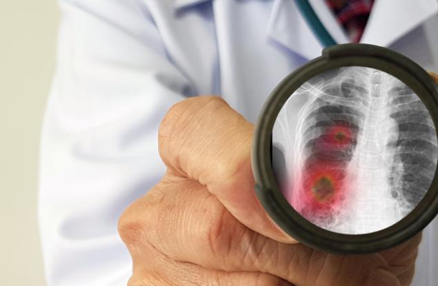 Ето как COVID-19 атакува човешкото тяло