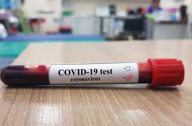 Тестове и пак тестове - експерти обясняват ниската смъртност от COVID-19 в Германия