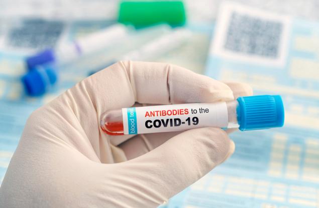 COVID-19: Кога да си направим тест за антитела?