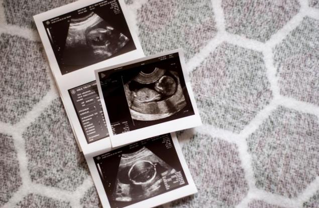 Колко точно трае всеки триместър