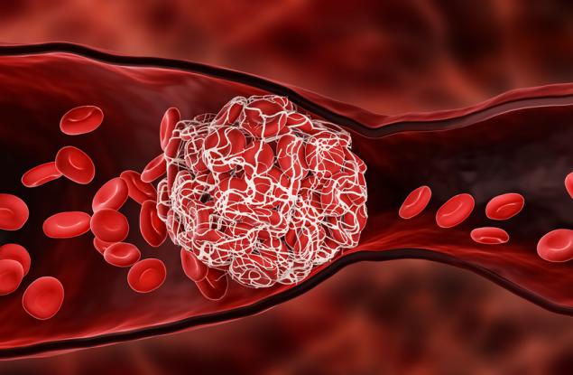 Изследване открива нови начини за предотвратяването на смъртоносни кръвосъсирвания