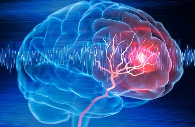 Капки за нос защитават мозъка от някои от последиците от инсулт