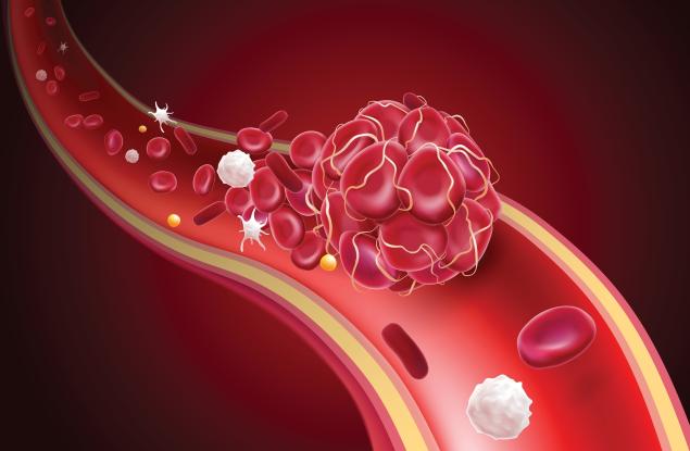 Учени от Университета Макмастър откриха ново заболяване на кръвосъсирването