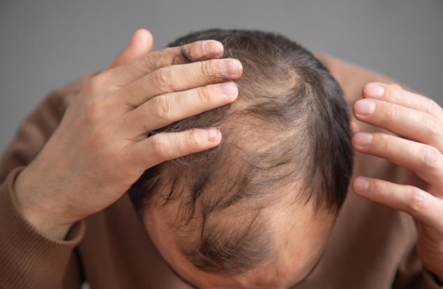 Ново проучване разкрива протеин, който стимулира растежа на косата при възрастни