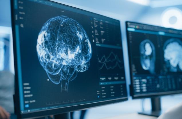 Алтруизмът забавя стареенето на мозъка