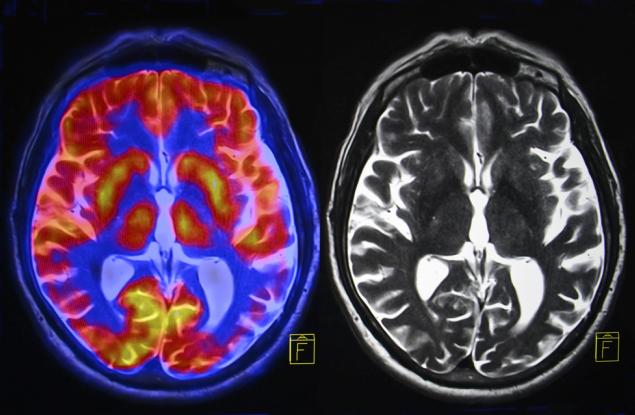 Най-мощният апарат за ядрено-магнитен резонанс в света е готов да разкрие тайните на човешкия мозък 