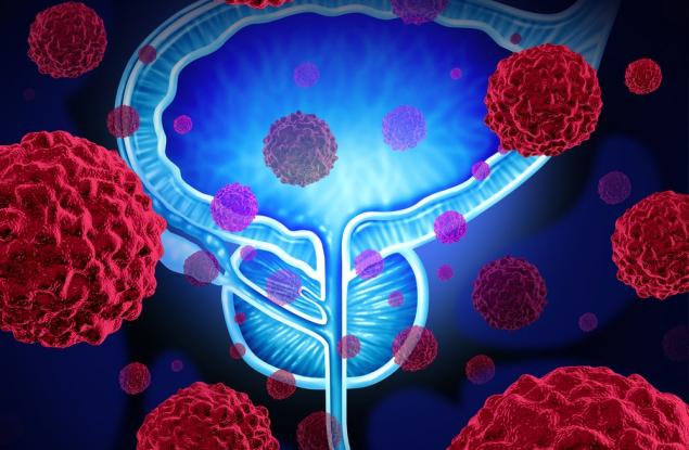 Създадоха тест за рак на простатата, работещ на принципа на теста за бременност