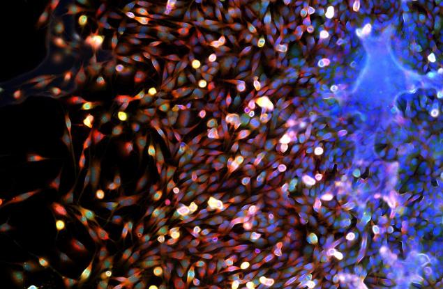 Вероятно никога няма да има универсален лек срещу рак, сочи мащабен 9-годишен анализ