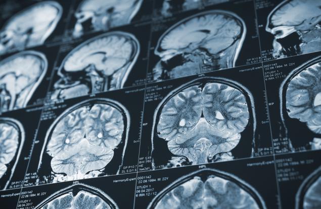 Франция спря проучванията на прионовите болести, след като втори лаборант хвана смъртоносно мозъчно заболяване