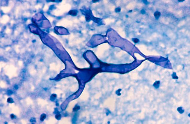 Терапия с антитела: Нов пробив в лечението на смъртоносната мукормикоза