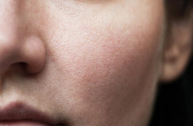 Дори нормално изглеждаща кожа може да крие рак