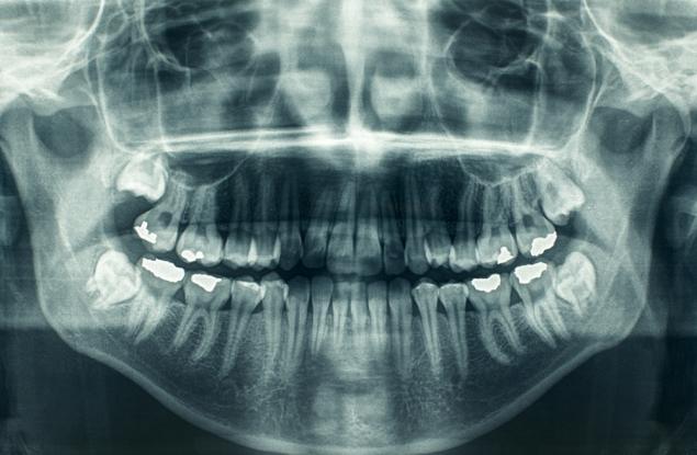 Ето как експлодиращите звезди са образували калция в нашите зъби и кости