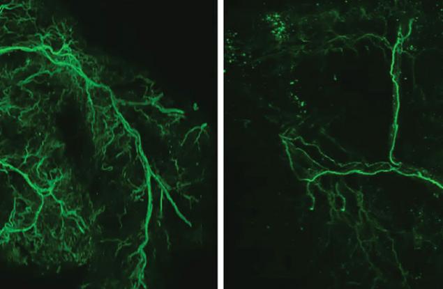 Активирането на специфична мозъчна клетка удължава продължителността на живота на мишките със 70 дни
