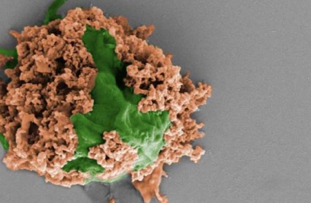Миниатюрни роботи прочистиха успешно пневмония от дробовете на мишки
