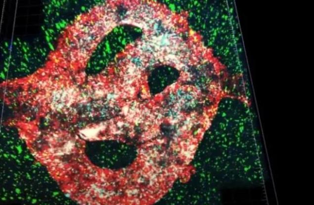 За първи път 3D принтираха смъртоносен тумор на мозъка в лаборатория