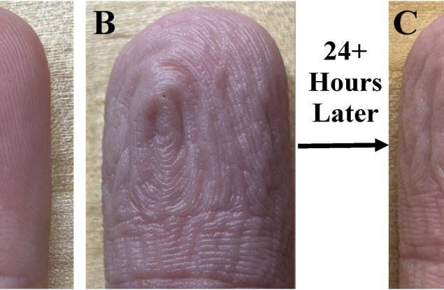 Пръстите ви се сбръчкват по един и същи начин всеки път, когато се застоите във вода