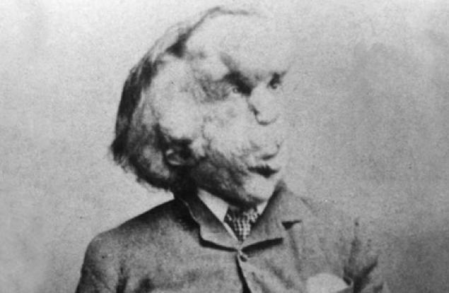 Откриха останките на Човека слон