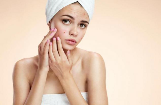 Идея на помощ: 4 съвета за избавяне от проклятието на всеки тийнейджър