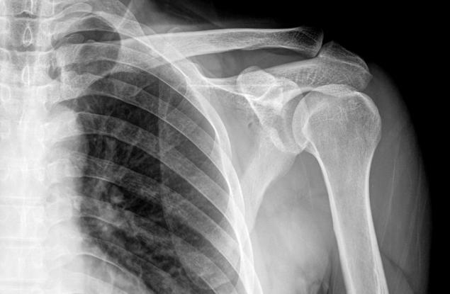 В СССР са презаписвали забранени плочи върху рентгенови снимки