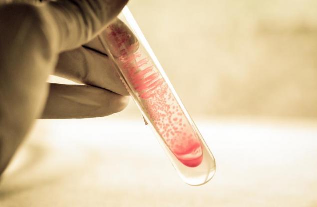 4 неща, които трябва да знаете за антибиотичната резистентност