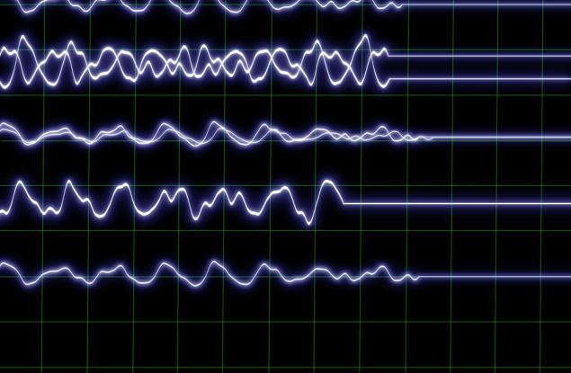 Какво се случва в тялото и съзнанието, когато сърдечната дейност спре?