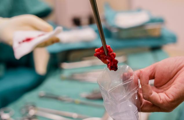 Идва краят на болезнените и рискови биопсии?