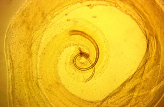 Най-ужасните паразити на света - пренебрегваните тропически болести