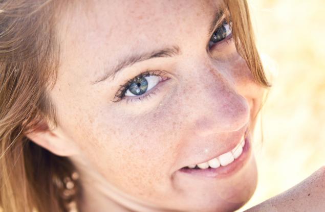 Защо имаме лунички?