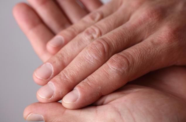 8 начина да се грижите за сухата кожа през зимата