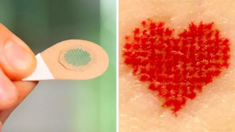 Скоро татуирането може да бъде безболезнено благодарение на тези микроскопични игли, пълни с мастило