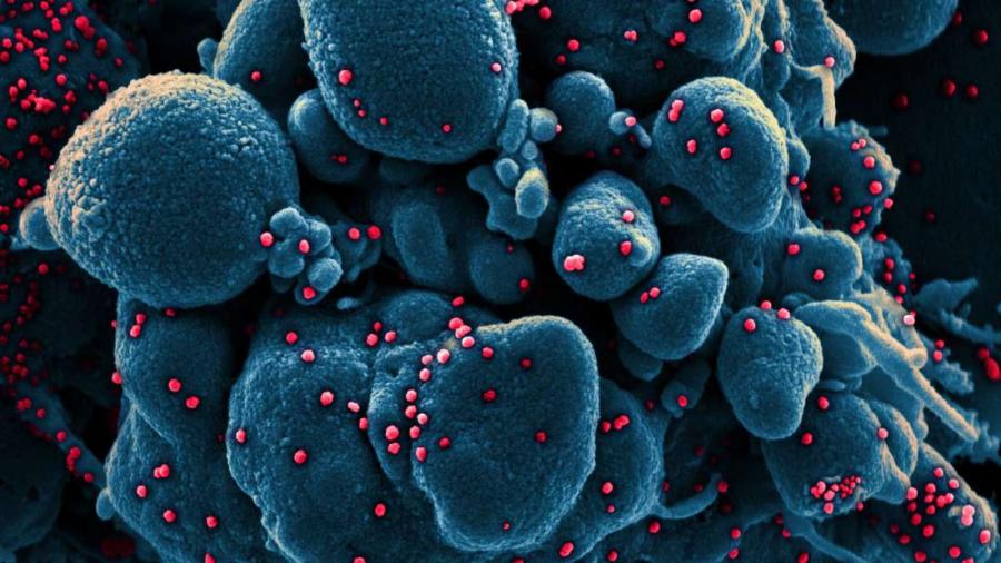 Снимки показват как новият коронавирус „убива“ човешка клетка