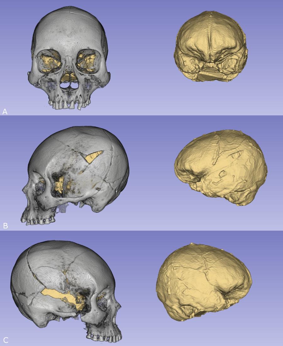 Модерният начин на живот обяснява защо хората в Чили днес са по-високи и с по-големи глави от своите предци