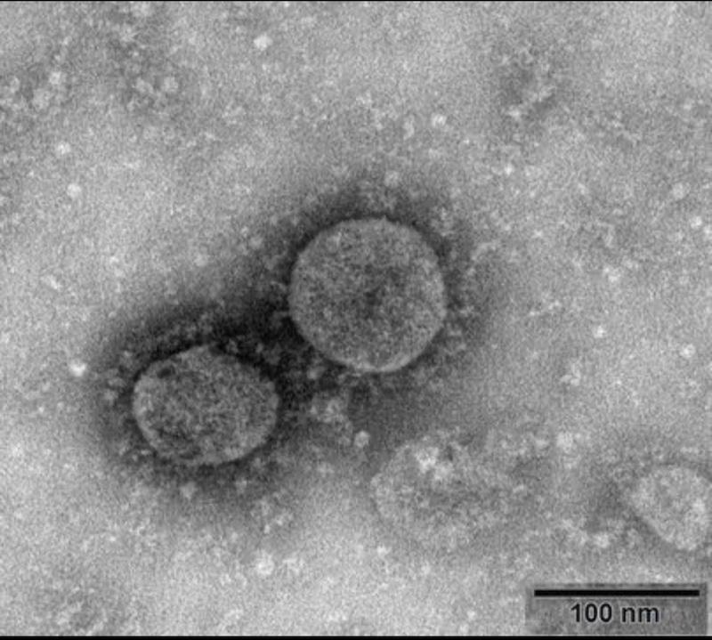 Близо 10 хил. вече са заразени с новия коронавирус, СЗО обяви международно извънредно положение