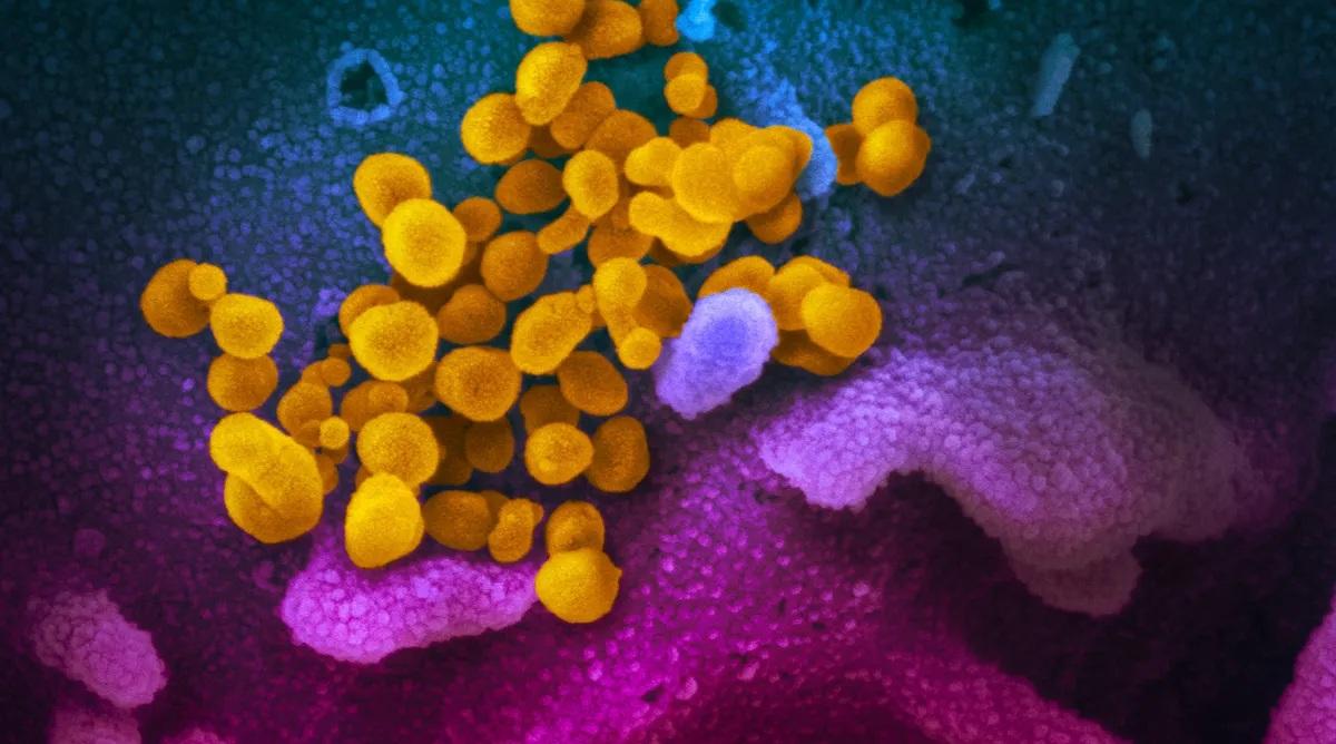 Мозъчни сканирания на хора, преболедували COVID-19, разкриват микроструктурни и химични промени