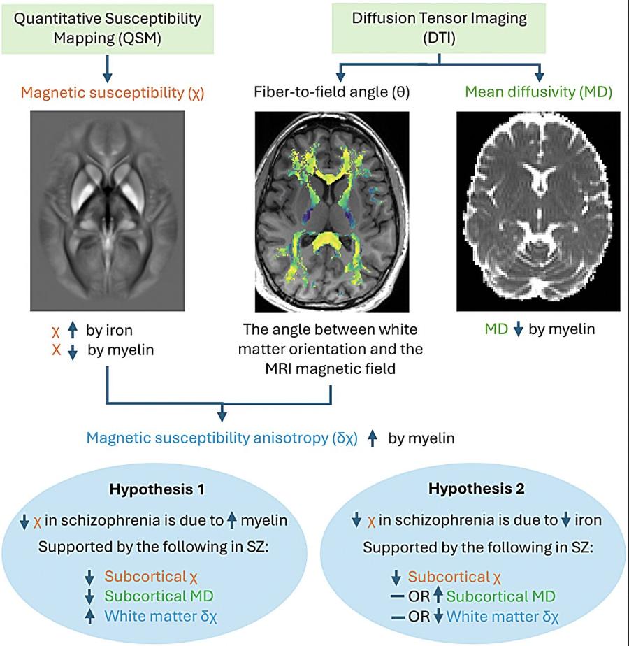 Шизофренията е свързана с дефицит на желязо и миелин в мозъка