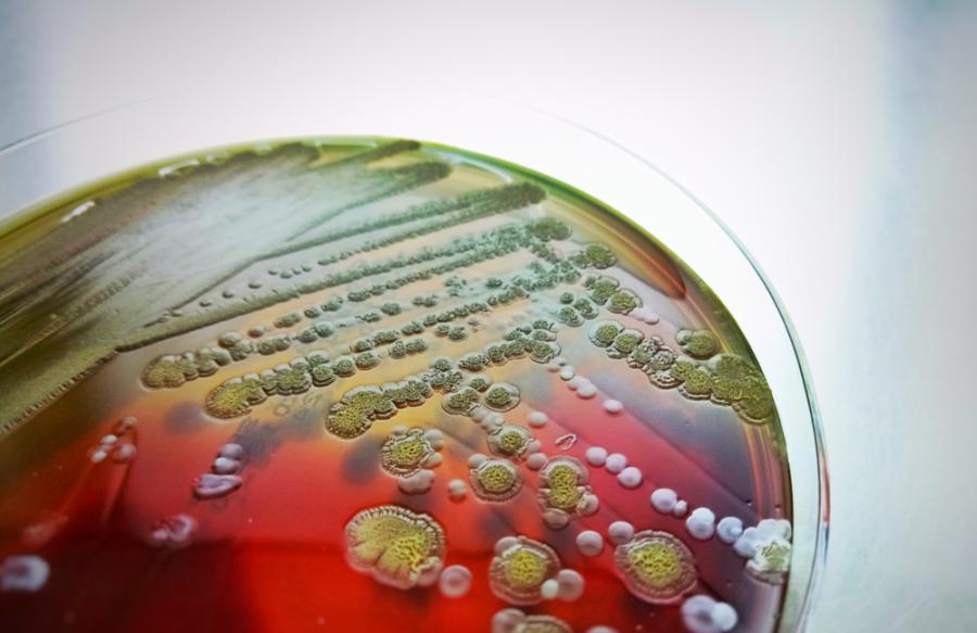 Нов тест показва кои антибиотици действително унищожават опасните бактерии