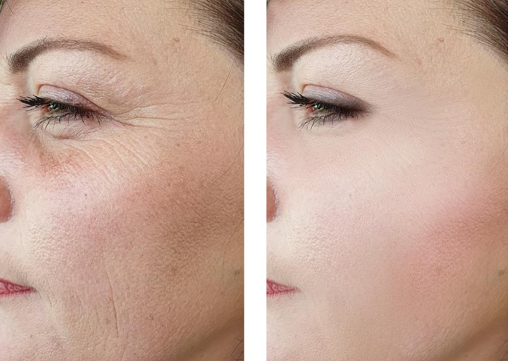 Най-важният признак за остаряването при жените — и това съвсем не са бръчките