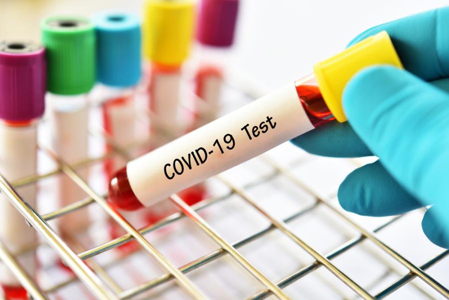 Разочароващо: Медикаментите срещу ХИВ не са ефективни срещу COVID-19