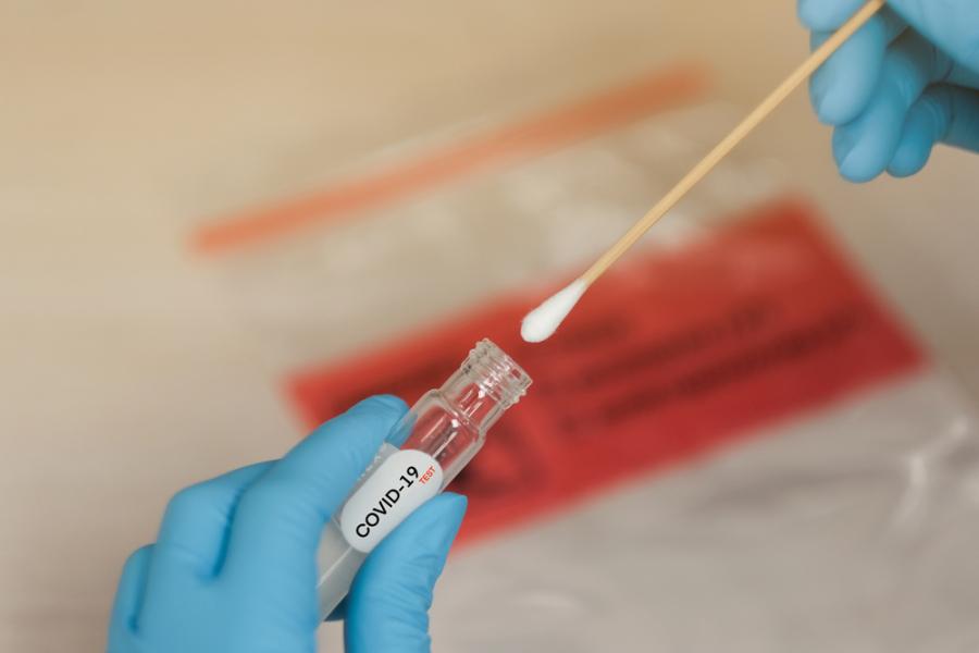 Домашен тест за коронавирус дава резултат за 5 минути