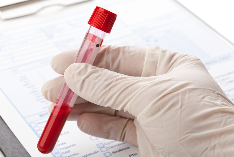 Нов вид кръвен тест открива над 50 вида рак