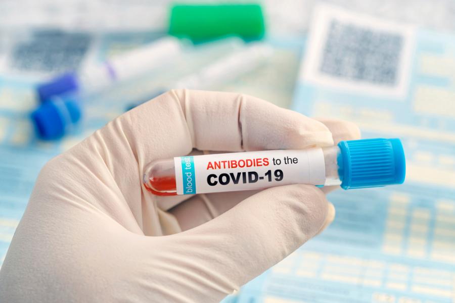 COVID-19: Кога да си направим тест за антитела?