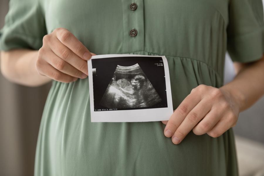 Майка забременя, докато е бременна, и роди 2 бебенца след 3 спонтанни аборта