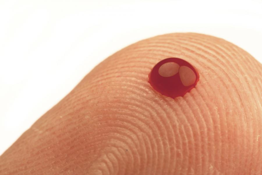 Капчица кръв може да разкрие нивото на хормоните на стреса в нашето тяло 