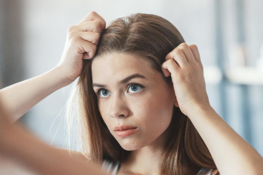 Косопадът при жените – как да се справим?