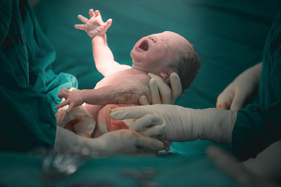 Как се променя бебето в първите дни след раждането