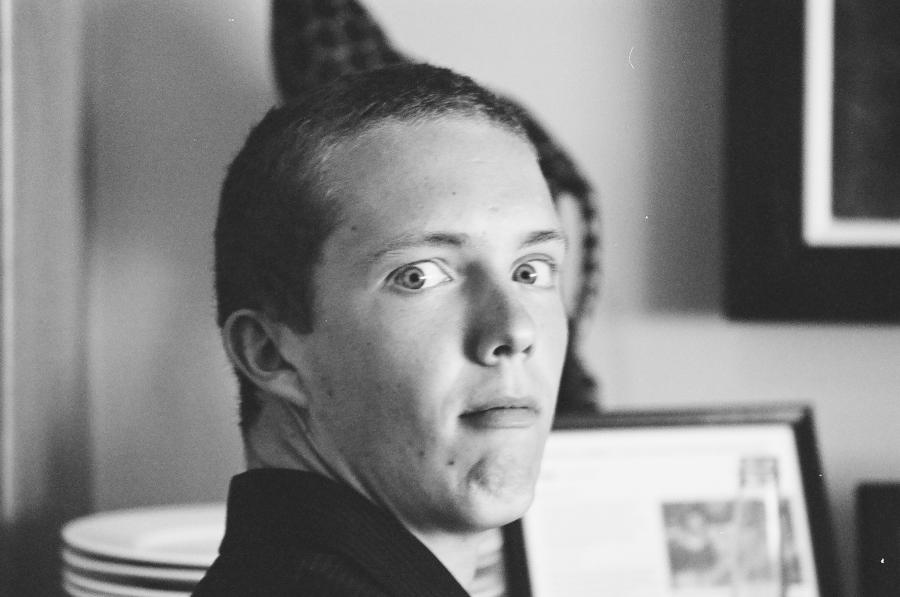 В Германия ще бъде проведена първата операция по присаждане на глава