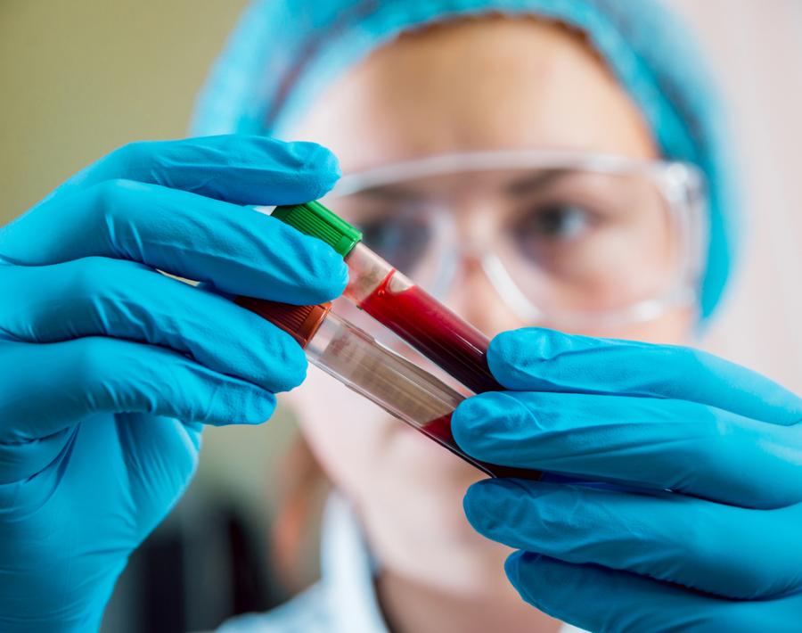 Кръвен тест за самоубийство: Промените в един ген предсказват риска 