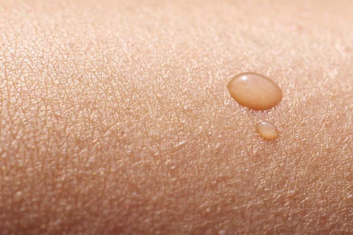 Тест: Крие ли кожата ви тайни от вас?